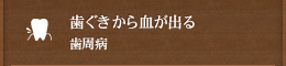 歯ぐきから血が出る